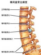 �����Ĳ�����ζ�����׵���ǹؽڼ��������õ�?