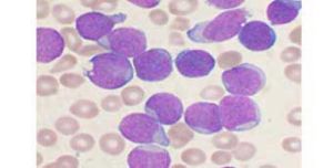 ��Ѫ���ܷ��ö����Ĳ���