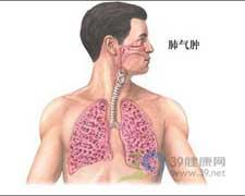 �����׿��ԳԶ����Ĳ��𣿷�������ô�Զ����Ĳݺã�